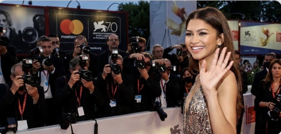 Hollywood’s Secret: Celebrities with Dental Implants (Before & After)